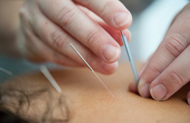 acupuncture for employees